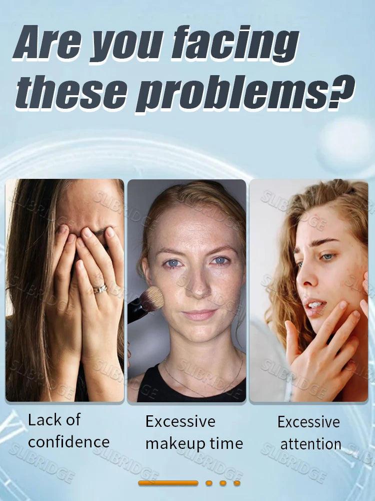 Dark Spot Treatment Cream